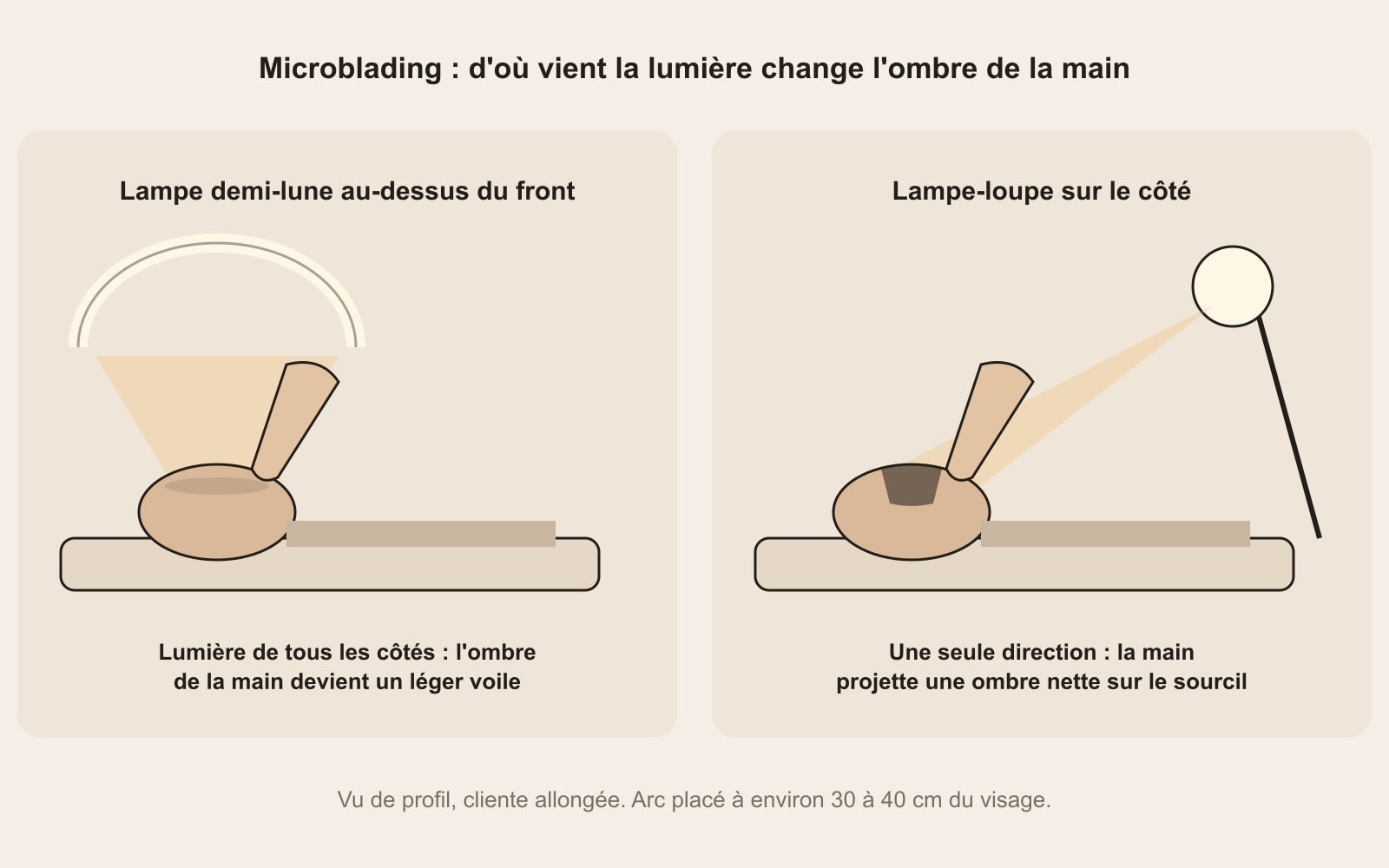 Schéma de profil, cliente allongée : la lampe demi-lune au-dessus du front éclaire de tous les côtés, la lampe-loupe sur le côté fait tomber l'ombre de la main sur le sourcil
